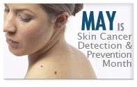 May is Melanoma-Skin Cancer Detection and Prevention Month