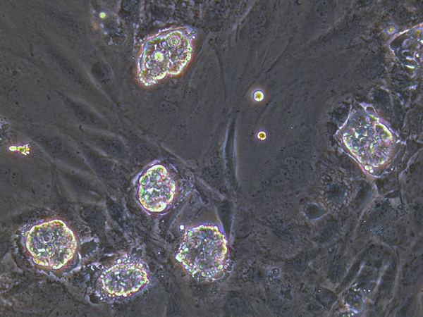 New national stem cell resource - Wellcome Trust Sanger Institute