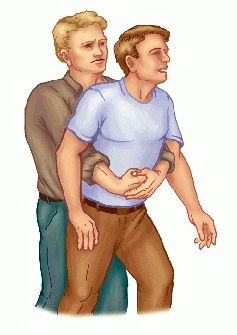 Canine CPR/Heimlich Maneuver recomendations for small dogs?